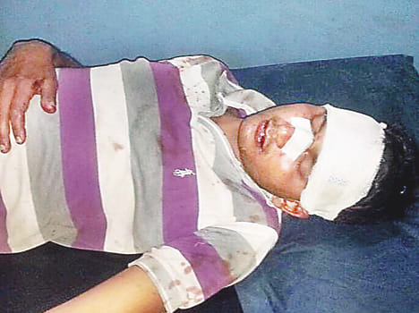   Youth in electoral rivalry attack 