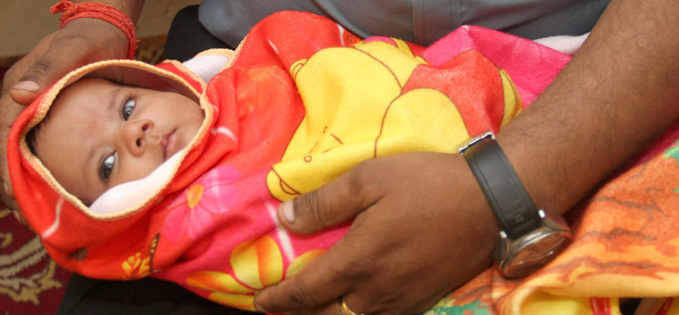 magic: by Rare surgery given to  new life of three days newborn