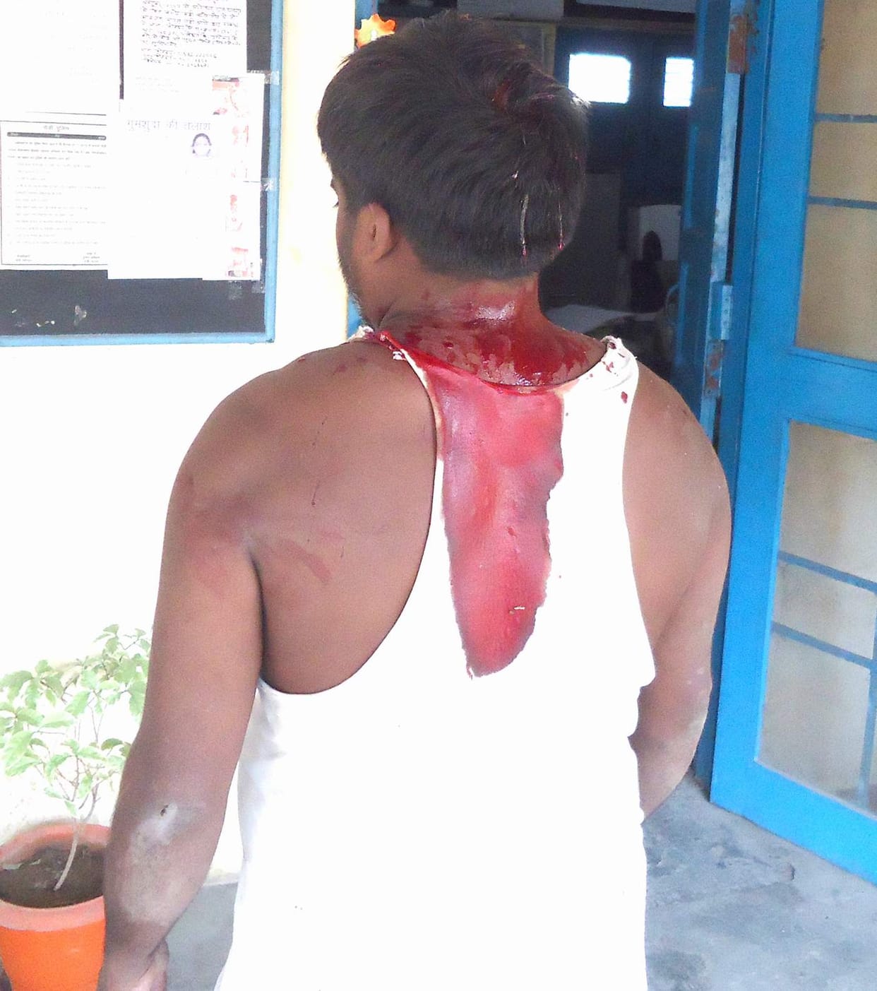 Rebars hit on the head in the transaction dispute