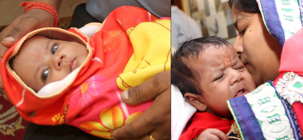 magic: by Rare surgery given to  new life of three days newborn