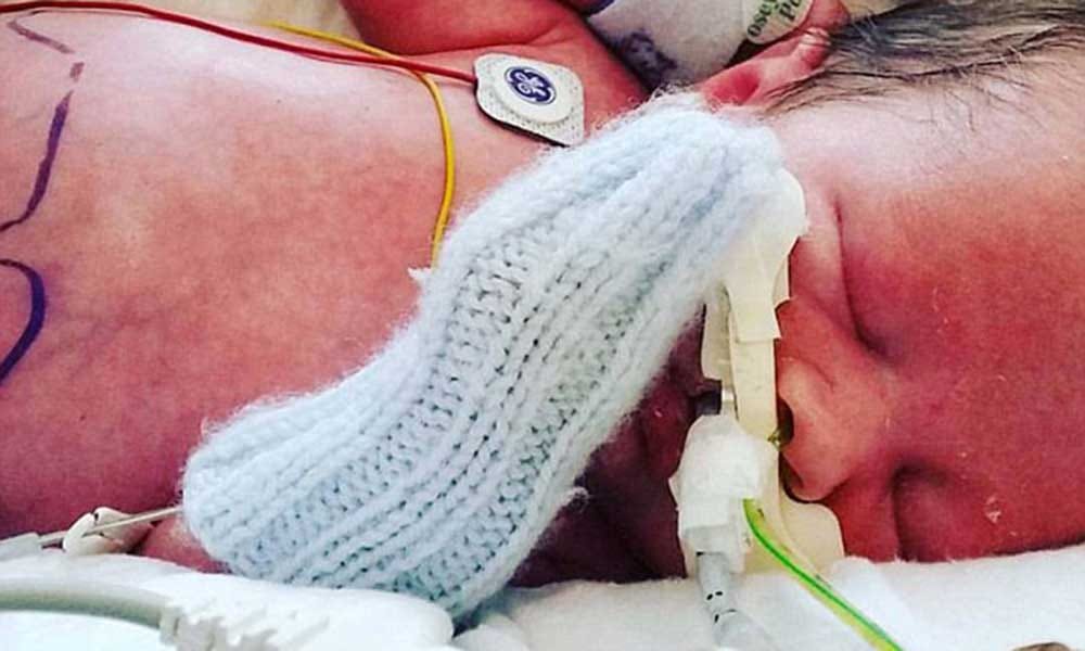 baby born with intestines out suffered 9 operations