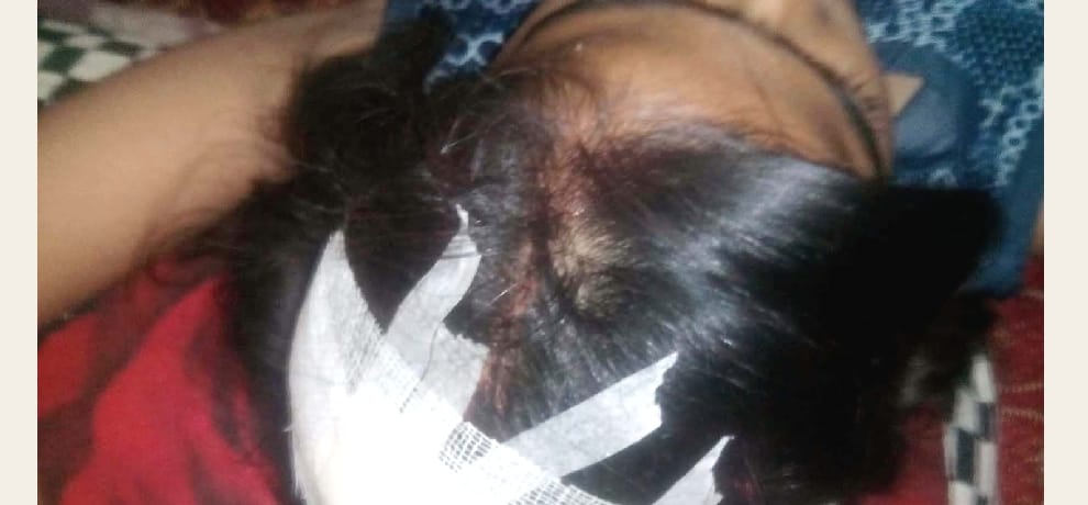  roof fall on students in school, 3 students injured.