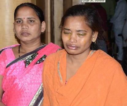 A man poured acid on his wife's face.