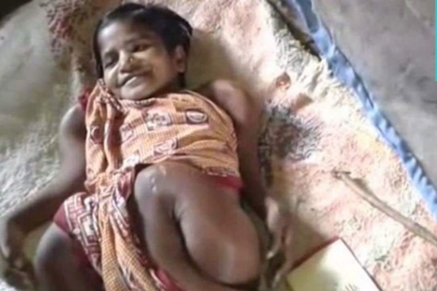 girl suffering from brittle bone disease