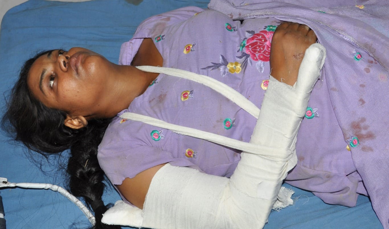 bus accident during CM rally, 40 injured