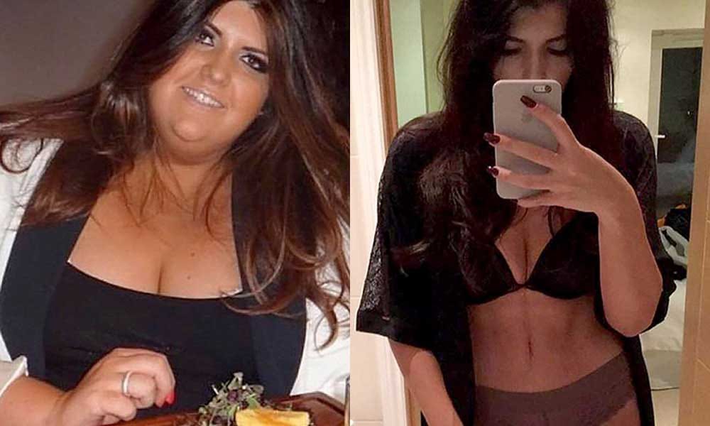 Obese woman lost 82 kgs and made bikini body