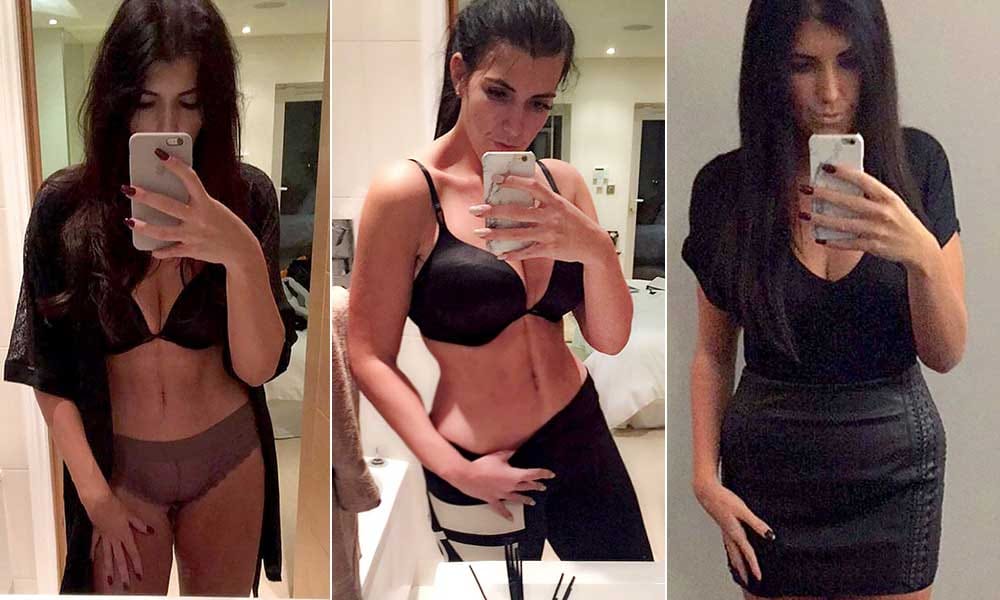 Obese woman lost 82 kgs and made bikini body