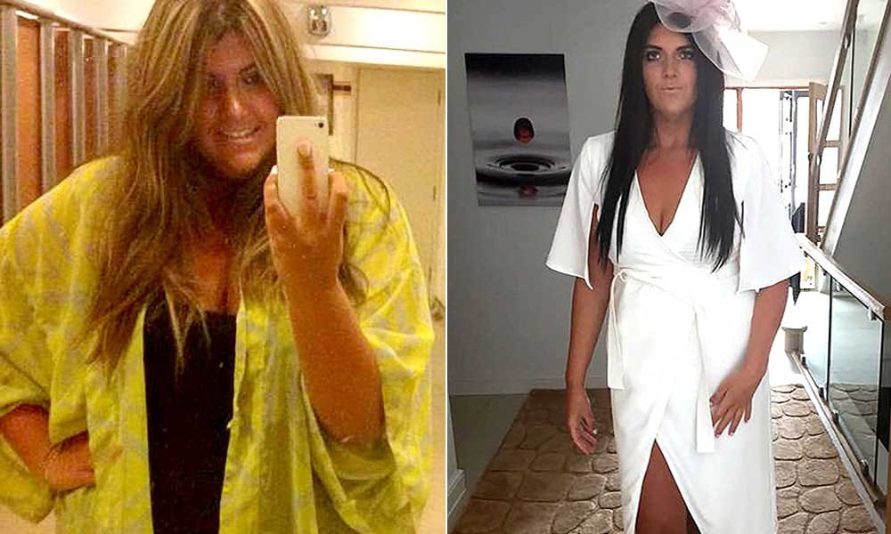 Obese woman lost 82 kgs and made bikini body