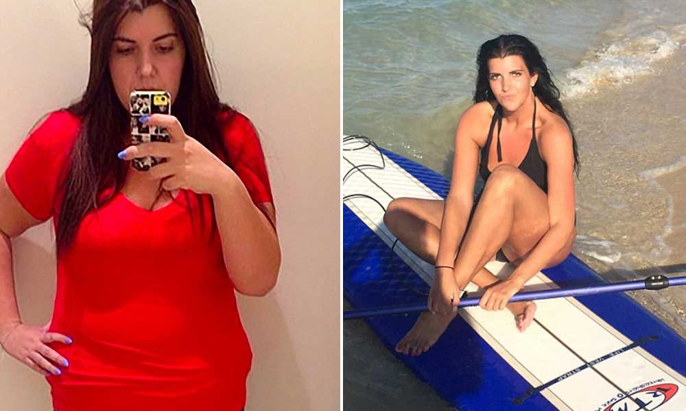 Obese woman lost 82 kgs and made bikini body