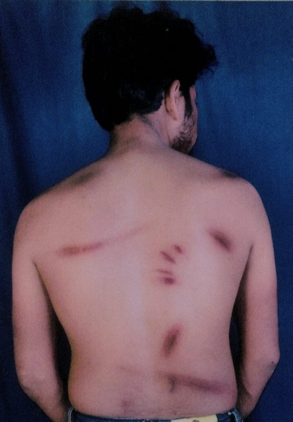 In Bajudehra assault, six injured