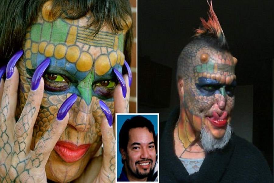 dragon man who had his nose and ears cut