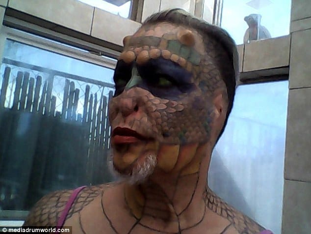 dragon man who had his nose and ears cut