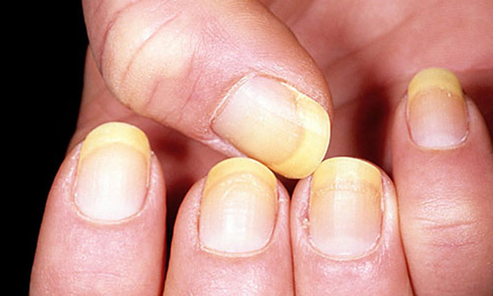 nails reveals about your health