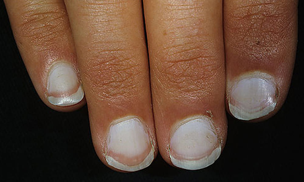 nails reveals about your health