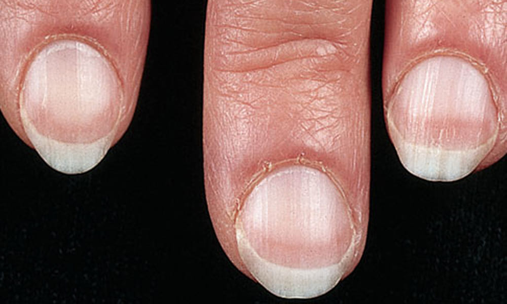nails reveals about your health