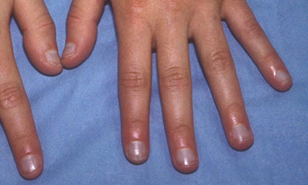 nails reveals about your health