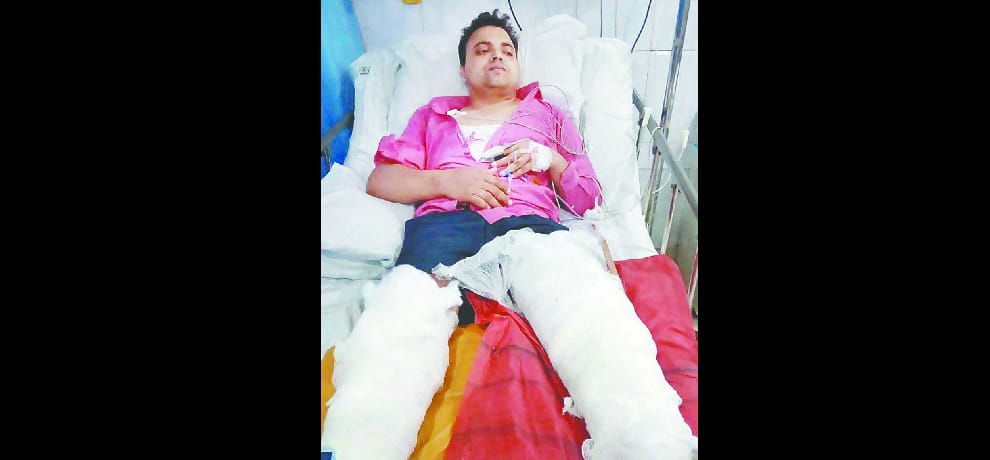 raodrage in delhi, scooty riders breaks car driver leg after car touches scooty