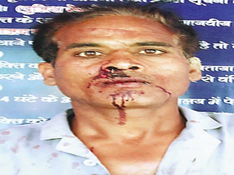Forty thousand rupees looted