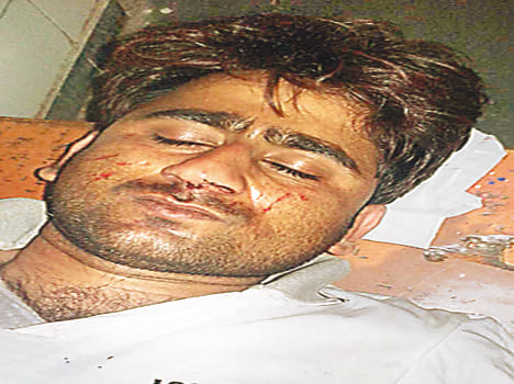 The young man beaten to soldier
