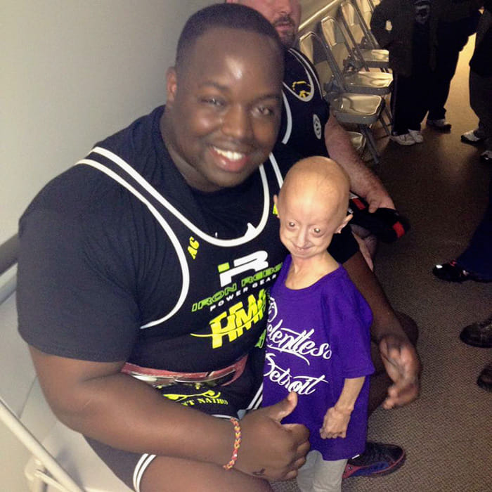 progeria affected girl gets a powerful friend