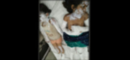 Incident: cylinder exploded five injured including three girls