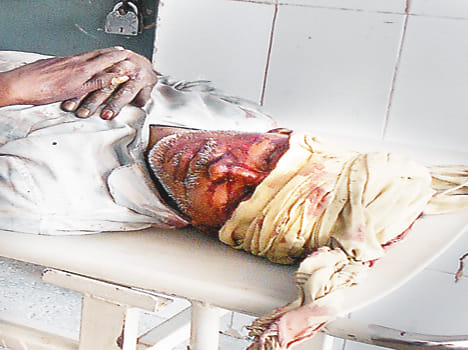 Five injured in road accidents, including three PWD person
