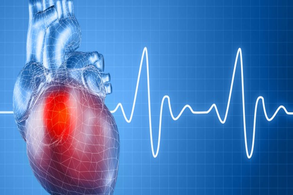 cardiac re-synchronization therapy
