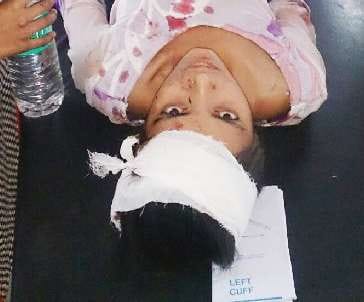Kalka, Road accident, Wounded,  Student