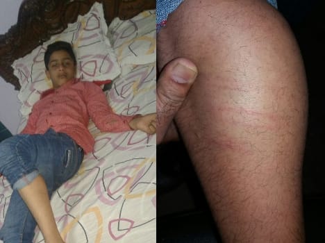A teacher beats a student brutally