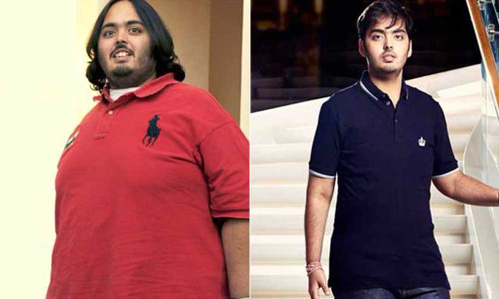 Anant Ambani 108 kgs Weight loss in 18 months without surgery