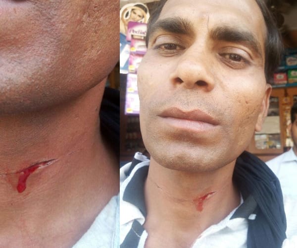 A man get injured by a manjha.