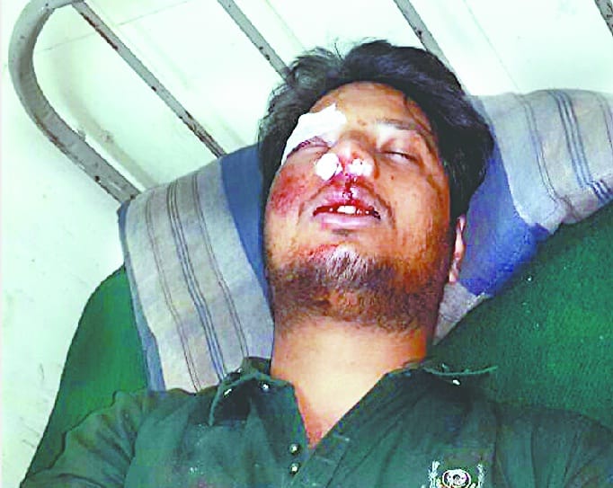 Delhi couple injured in car accident