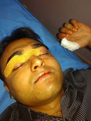 student injured by Chinese manjha 