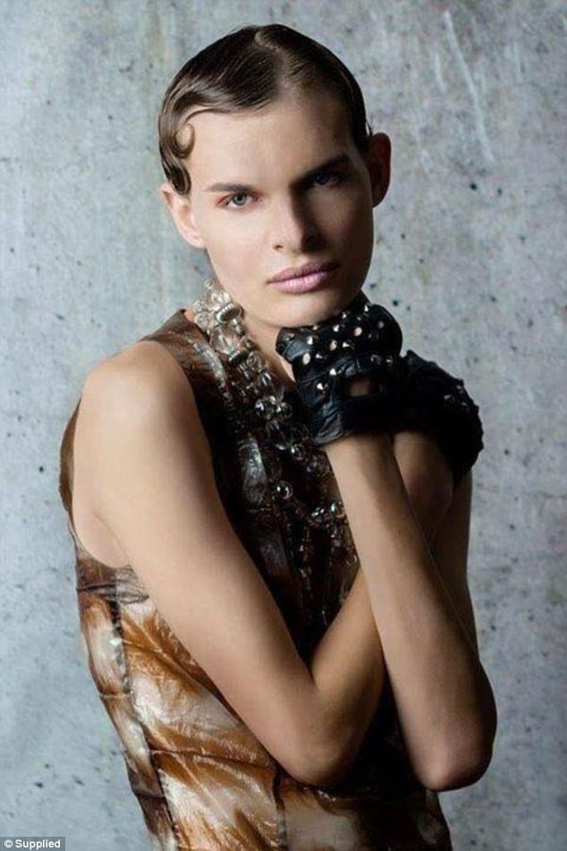 intersex australian who wants to be a female now