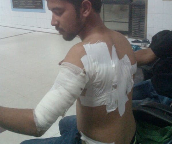 crime, studentes injured, cgc landran, mohali