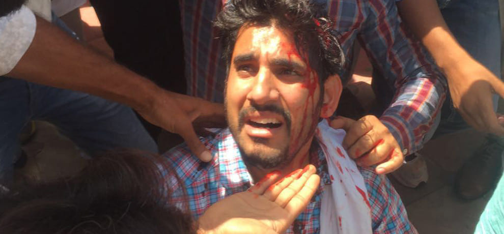 lathi charge on farmers in greater noida 