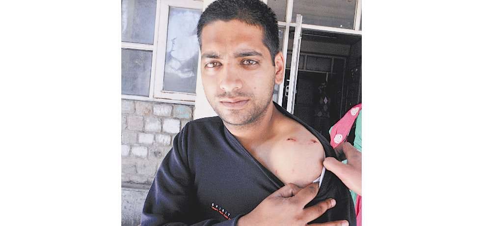 stray dogs terror, bite six peoples in shimla