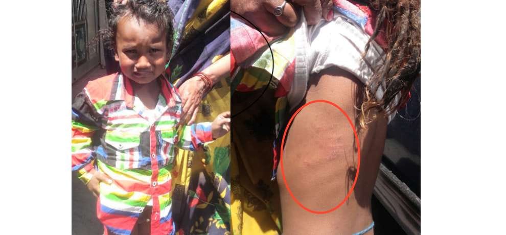 stray dogs terror, bite six peoples in shimla