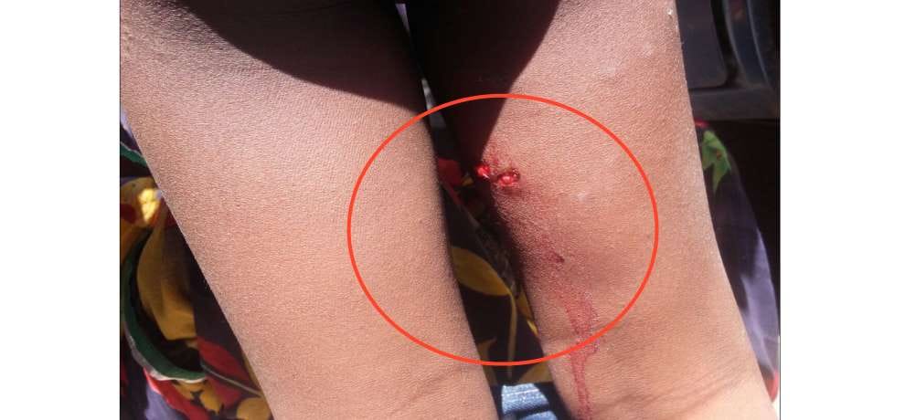 stray dogs terror, bite six peoples in shimla