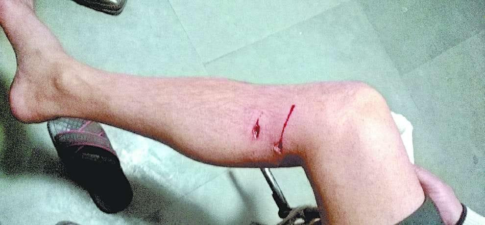 stray dogs terror, bite six peoples in shimla
