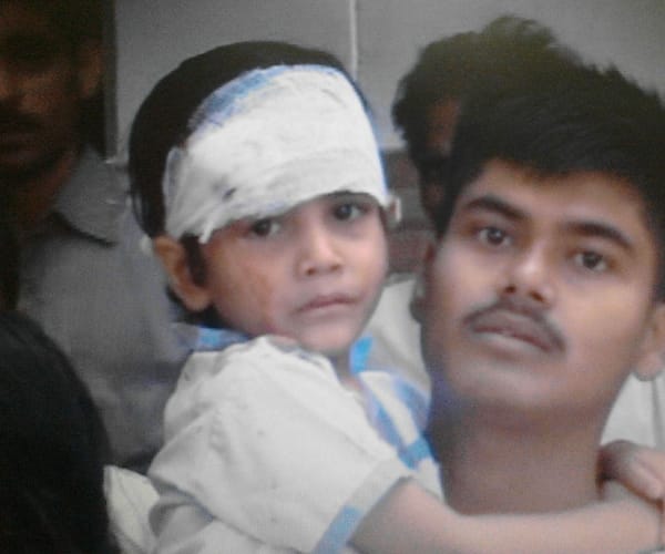 Five children injured in an accident.