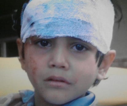 Five children injured in an accident.