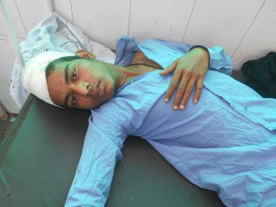 Four injured in accidents, one serious