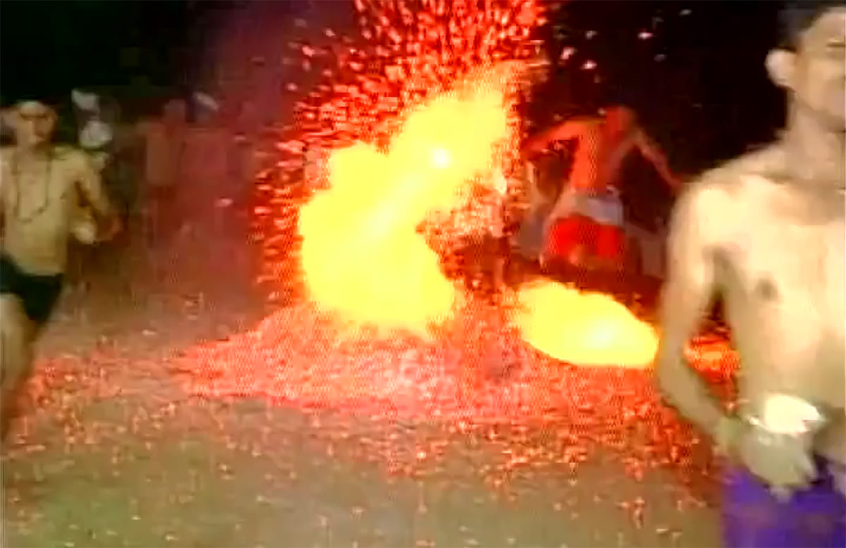 Married burnt in mysterious circumstances, broken back