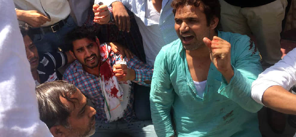  baton-charged on farmers in the front of Greater Noida authority