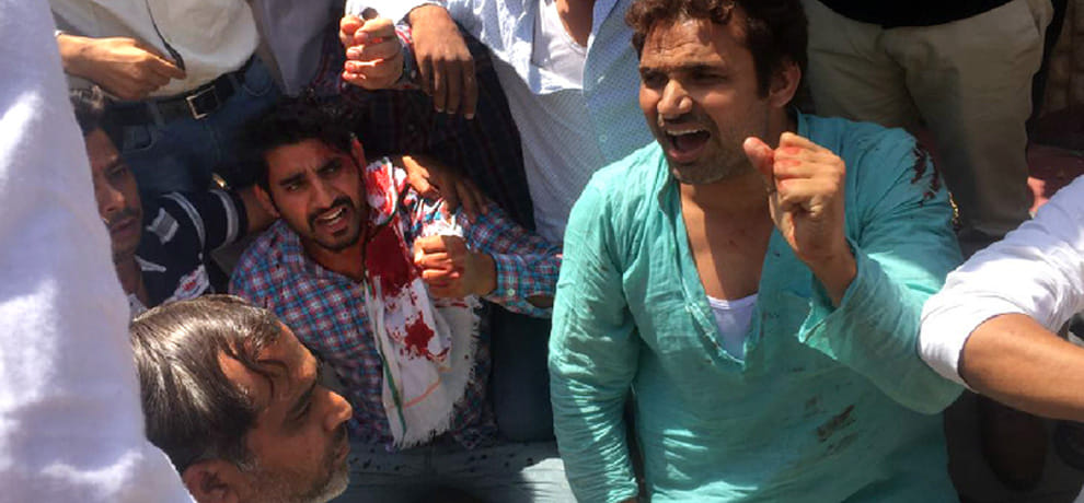  baton-charged on farmers in the front of Greater Noida authority