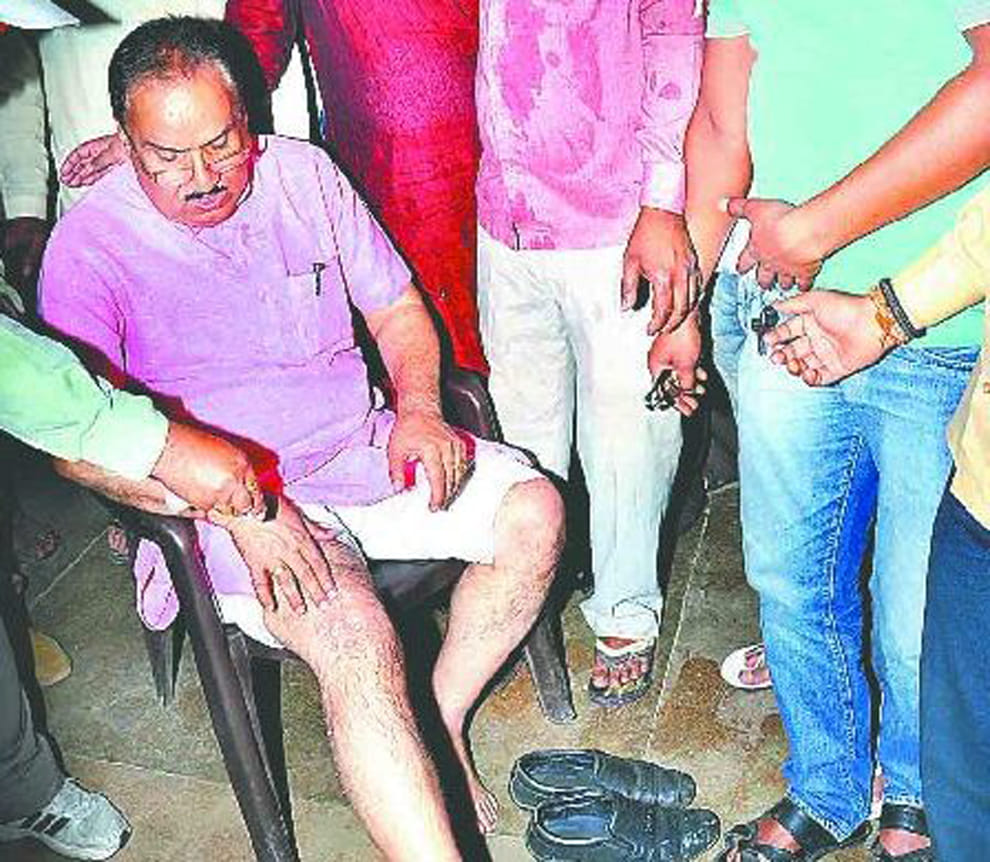 acid attack on former minister ravindra shukla