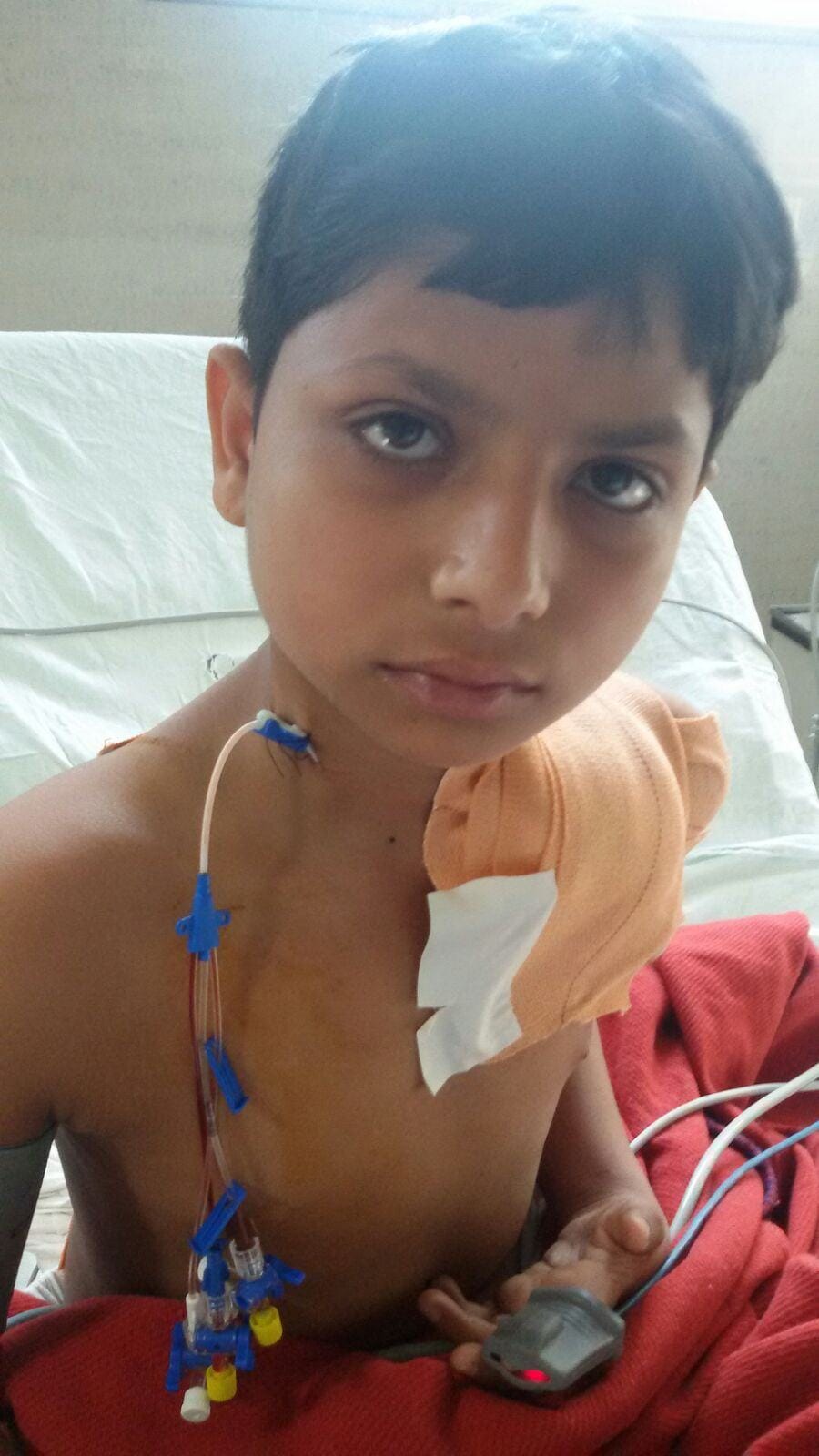 kgmu doctors operated nerve tumor