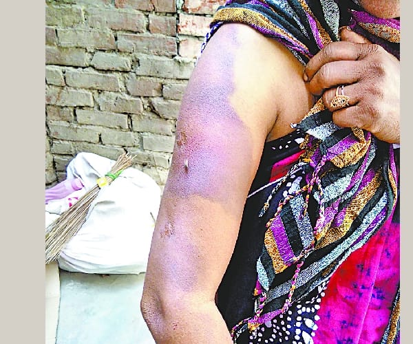  A women get torchered in Gonda.