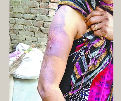  A women get torchered in Gonda.